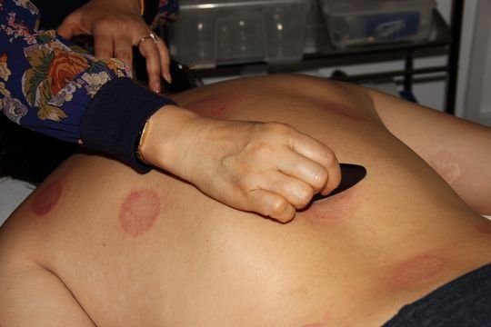 Tuina & Gua Sha